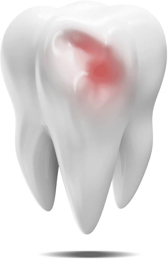 damaged tooth graphic Peabody, MA